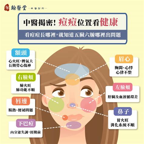 痘痘位置|青春痘、下巴痘痘長這個位置代表什麼意思？先弄懂長。